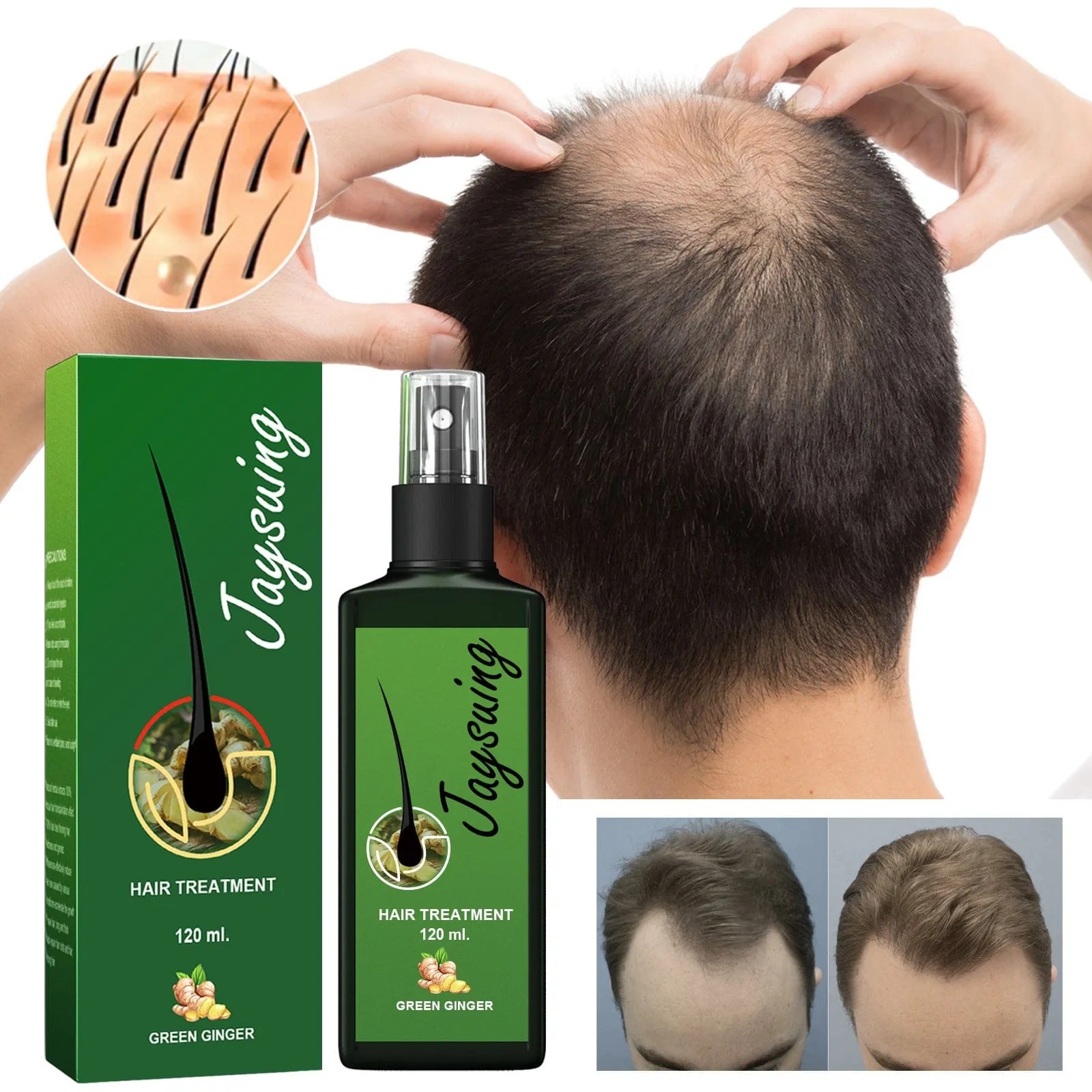 Hair Growth Spray Effective Nourishing