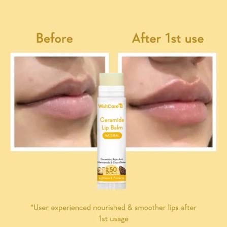 WishCare Ceramide Lip Balm with SPF 50 PA+++ (Natural)_img_2