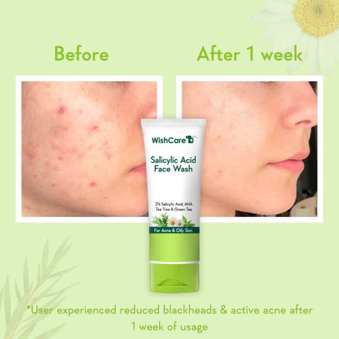 WishCare 2% Salicylic Acid Face Wash | 100ml_img_2
