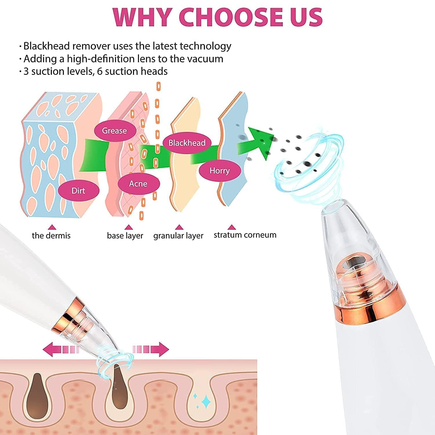 6 in 1 Multi-Function USB Rechargeable Blackhead Remover, Instrument Black Dot Remover, Acne Vacuum, Suction Face Clean, Black Head Pore Cleaning, Beauty Skin for Women_img_10
