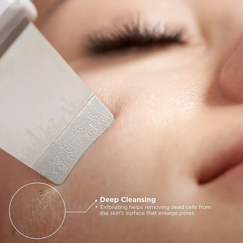 Ultrasonic Shovel BEAUTY START - Skin Scrubber, Face Spatula For Blackhead Removal And Cleansing Pores_img_13