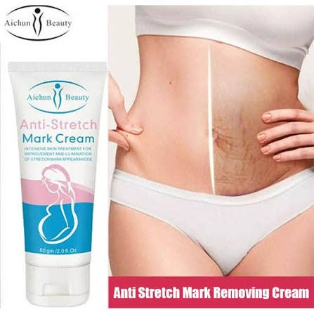 Anti Streach Mark Removal Cream