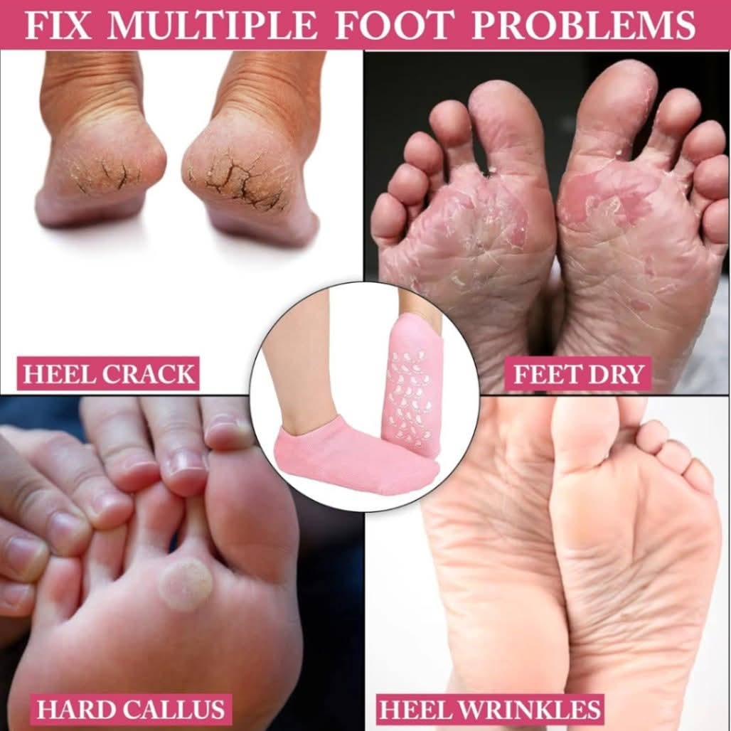 Spa Gel Socks for Cracked Heel Repair – Reusable Spa Gel Socks with Inner Silicone Lining for Dry & Cracked Feet Care thumbnail 3