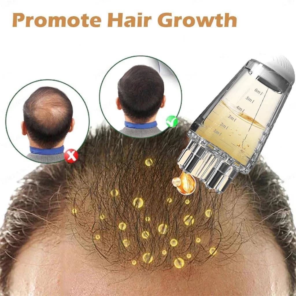 Scalp Applicator Liquid Comb Oil Liquid Guiding Massager Portable Mini Massage Comb Anti Hair Loss Scalp Care Tools thumbnail 2