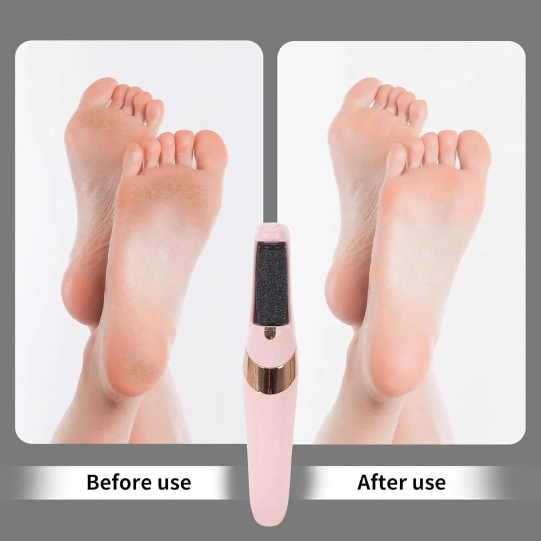 Electric Foot Pedicure Tools, Rechargeable foot callus remover pedicure machine thumbnail 2