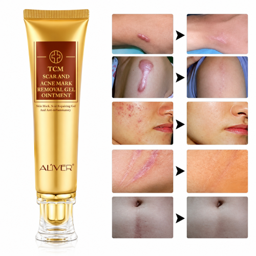 Lanbena TCM Scar and Acne Removal Best Price in Bangladesh_img_1