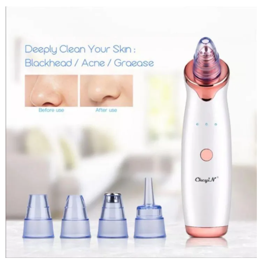 Multi-Functional Cleaning Blackhead Remover Vacuum - Image 1