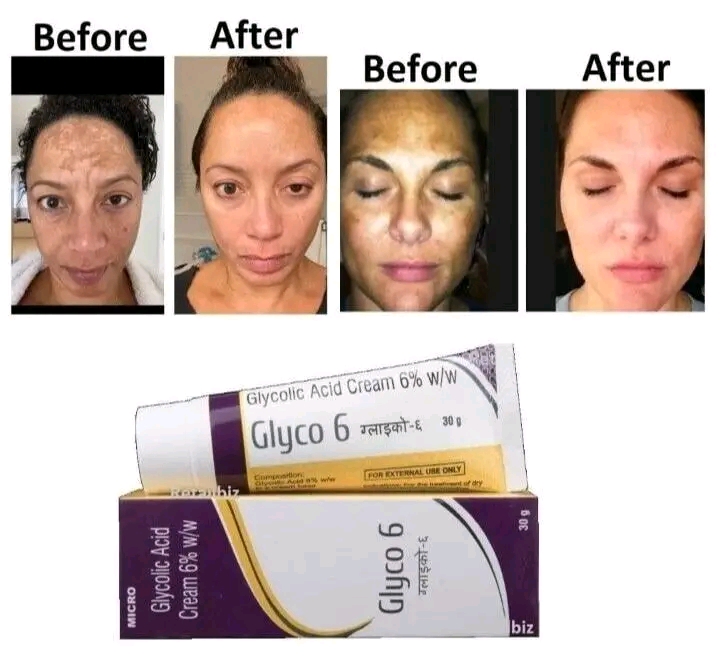 Glyco 6 Cream_img_1