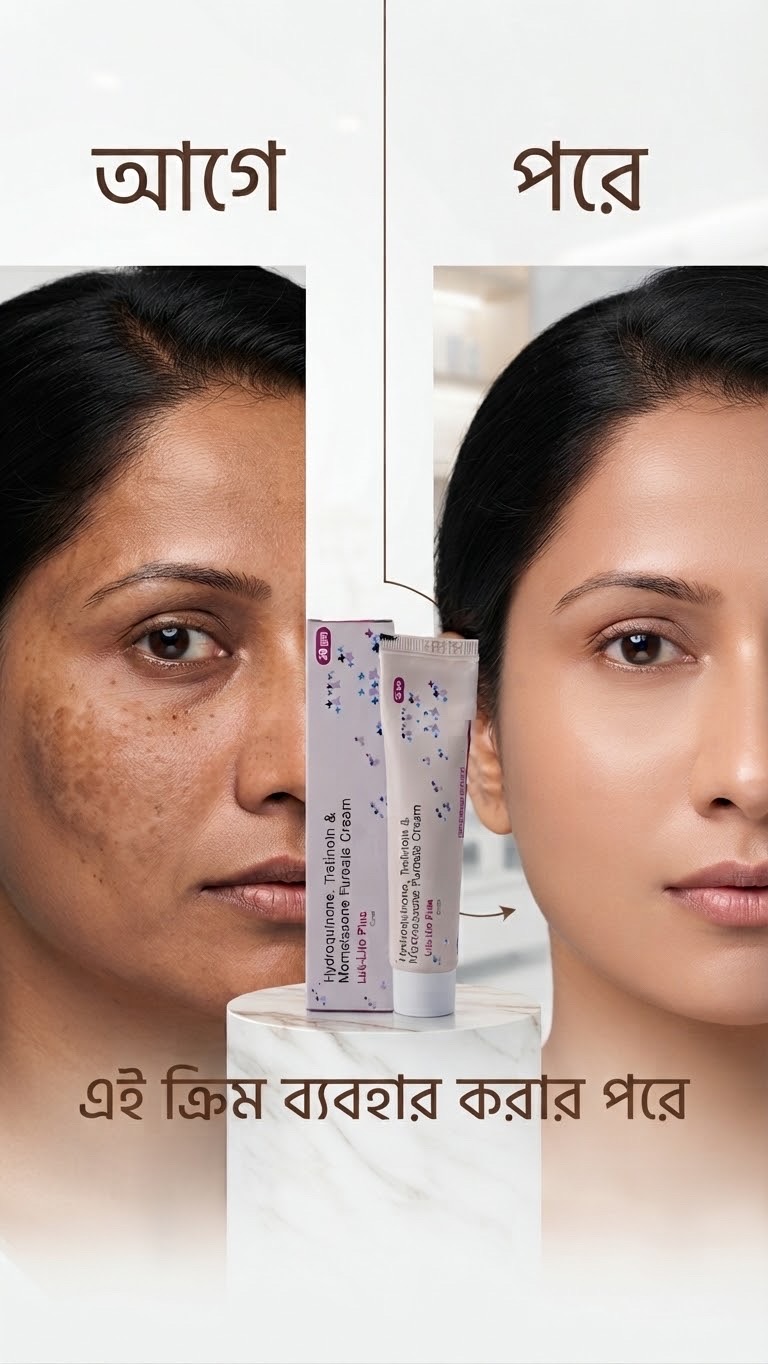 Luk lite Plus Cream -কালো দাগ ও মেছতা দুর করার ক্রিম [ Indian ]_img_4
