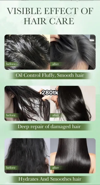 NS5105-Sadoer Rosemary hair care oil_img_2