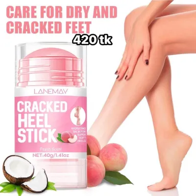 heel crack_img_0