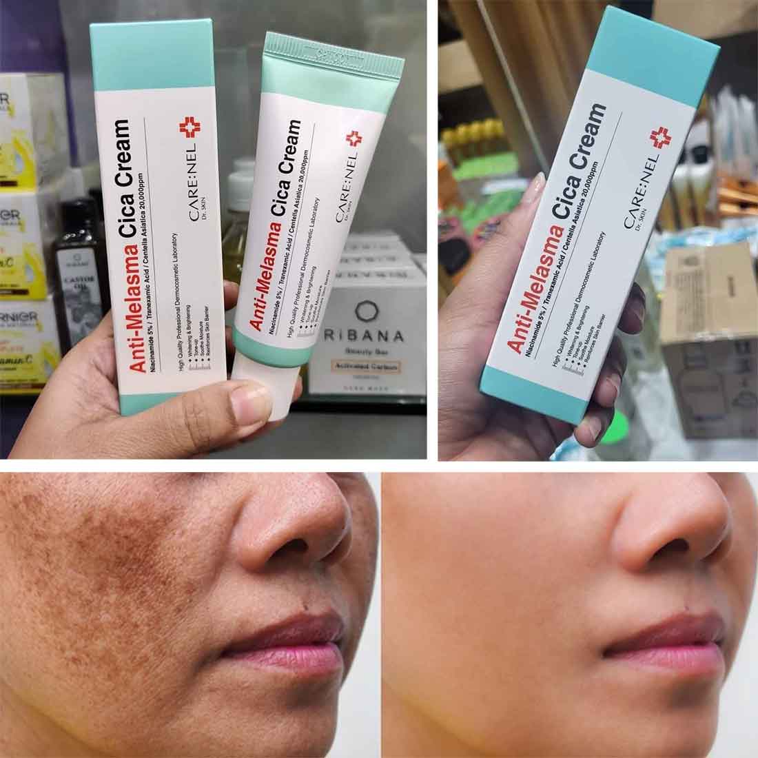 Care:Nel Anti-Melasma Cica Cream - 40ml_img_5