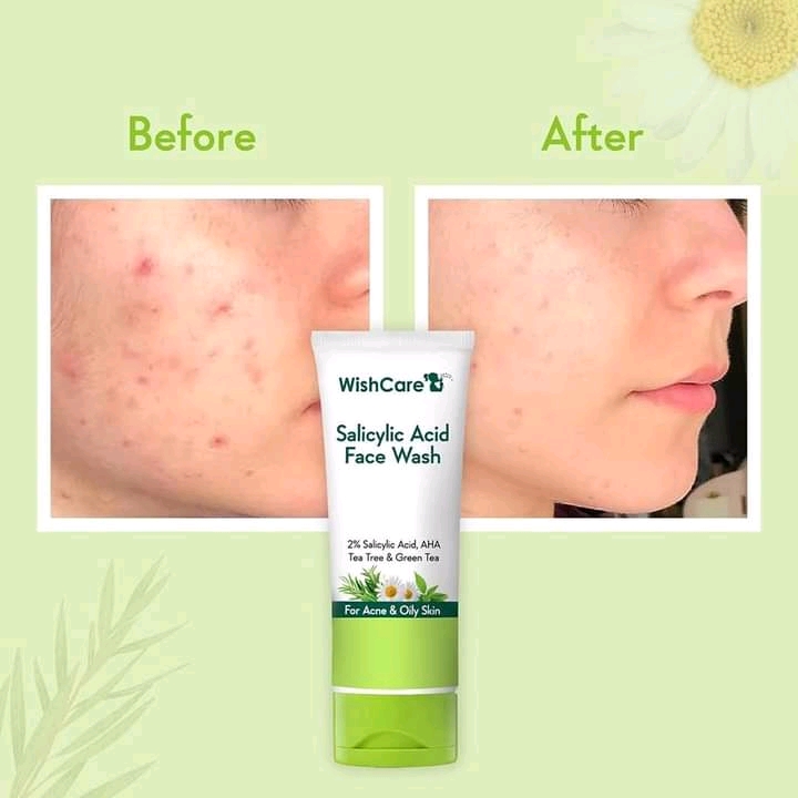 WishCare 2% Salicylic Acid Face Wash 100ml_img_2