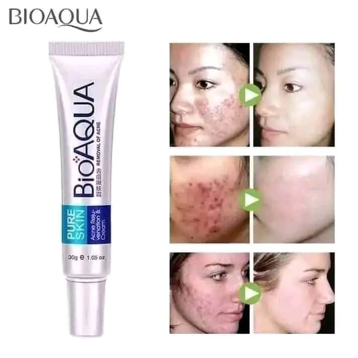 BIOAQUA PURE SKIN ACNE REMOVAL CREAM
