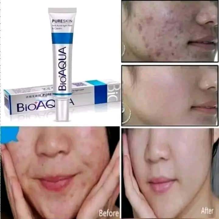 BIOAQUA PURE SKIN ACNE REMOVAL CREAM_img_1