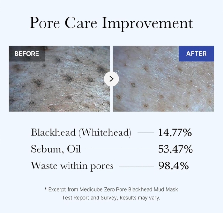 Medicube Zero Pore Blackhead Mud Facial Mask - 100g_img_4
