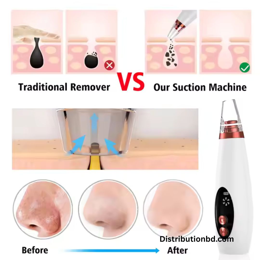 Blackhead Remover_img_3
