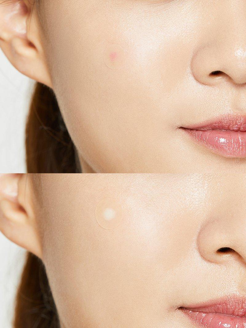 COSRX - Acne Pimple Master Patch - 24p thumbnail 4