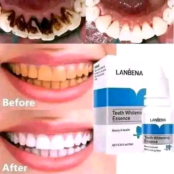 LANBENA teeth whitening essence._img_3