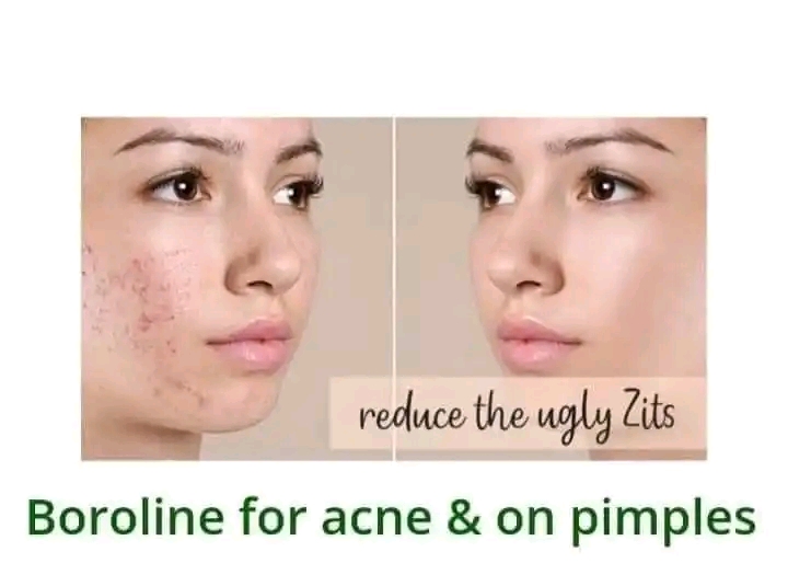 boroline antiseptic night repair cream 20gm_img_1