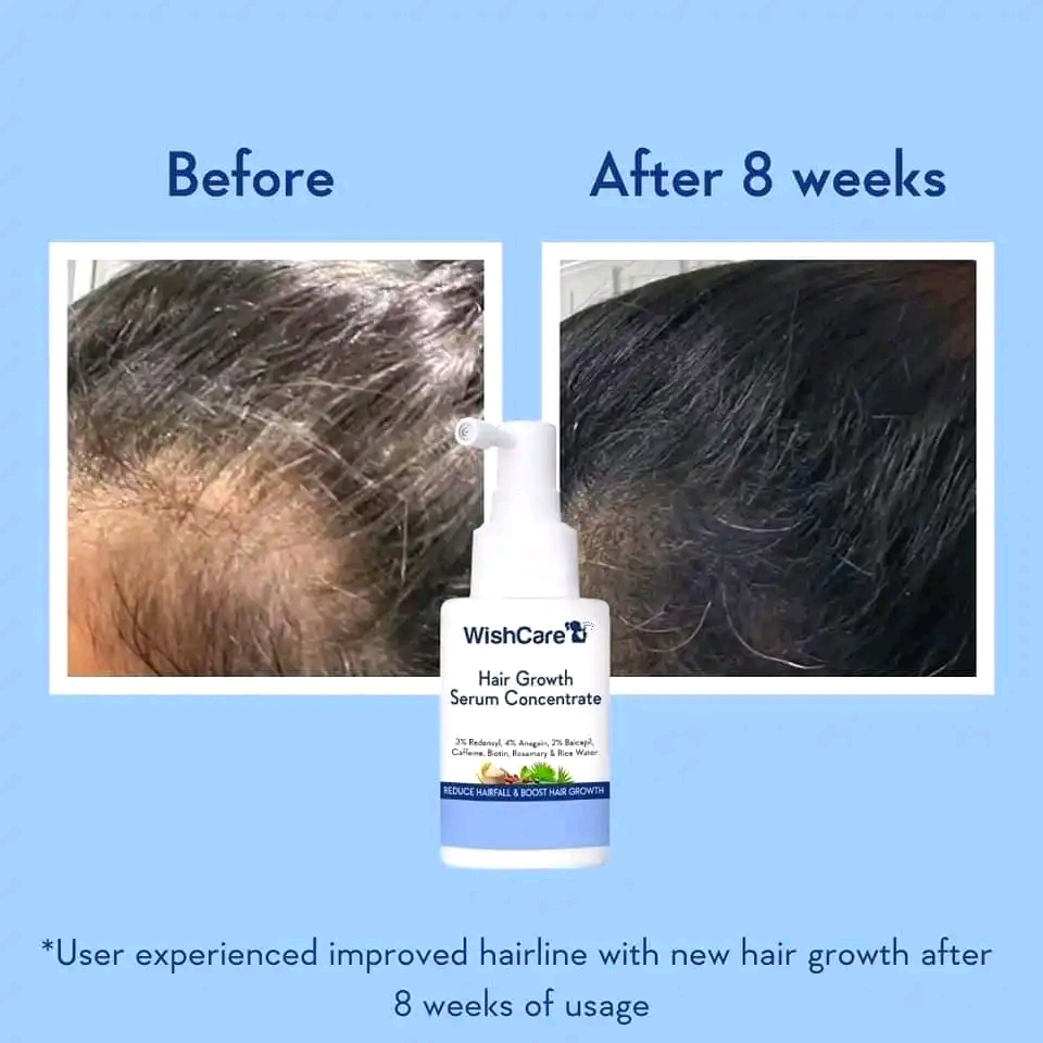 Wishcare hair growth serum 30ml_img_1