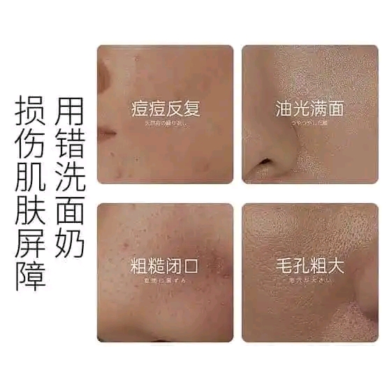 Osufi 𝐕𝐢𝐭𝐚𝐦𝐢𝐧 𝐁𝟓 𝐒𝐚𝐥𝐢𝐜𝐲𝐥𝐢𝐜 𝐀𝐜𝐢𝐝 𝐁𝐫𝐢𝐠𝐡𝐭𝐞𝐧 𝐅𝐚𝐜𝐞 𝐖𝐚𝐬𝐡 - 𝟏𝟎𝟎𝐠𝐦_img_3
