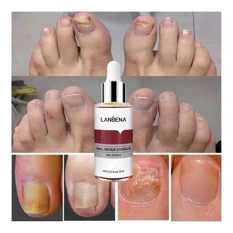 LANBENA Nail Repair Essence Serum-15ml_img_3