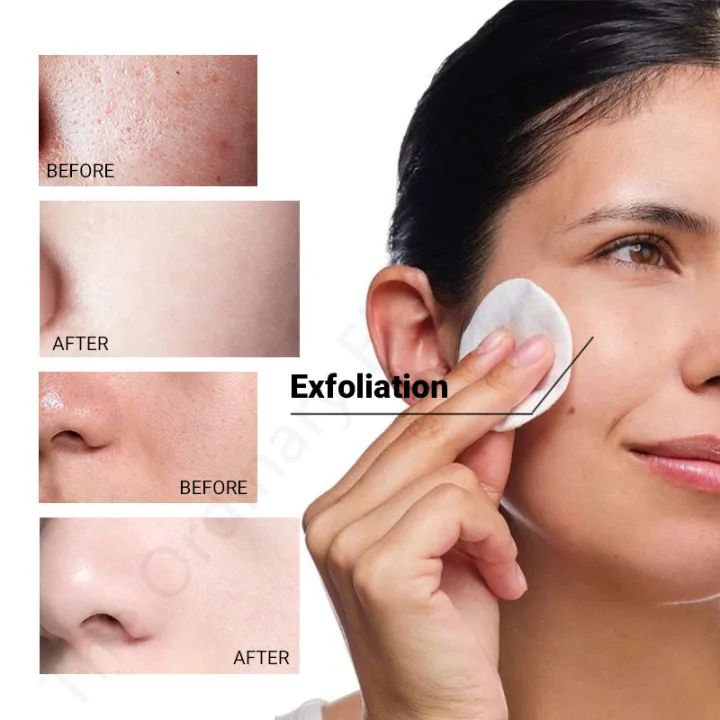 The Ordinary Glycolic Acid 7% Exfoliating Toner_img_6