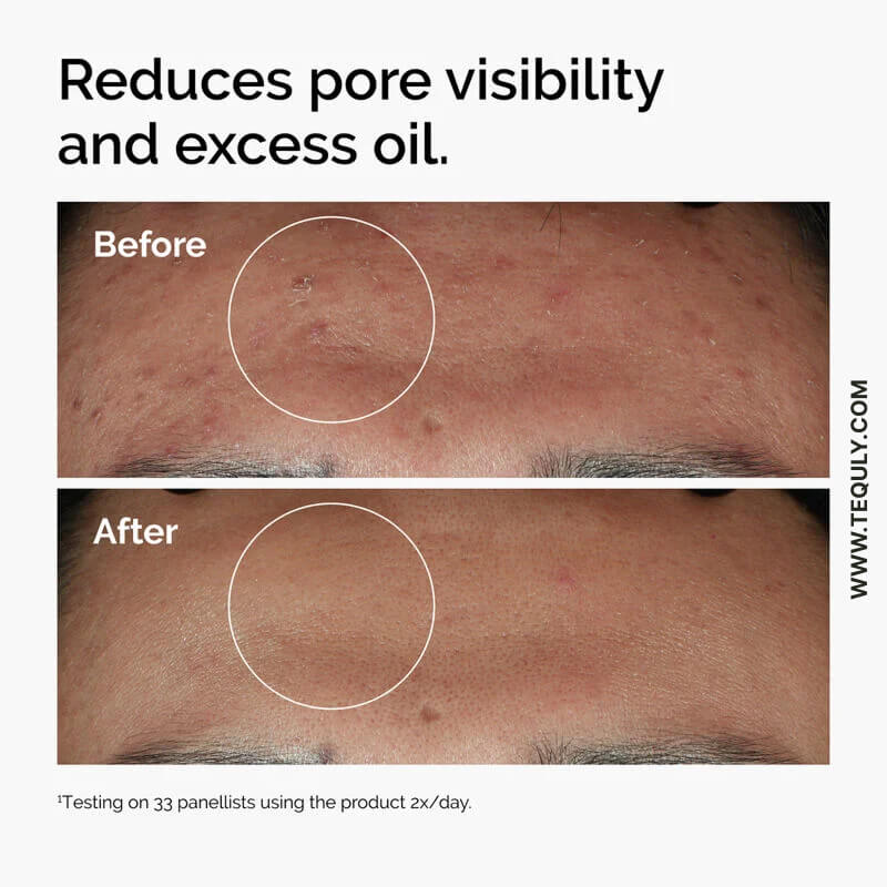 The Ordinary Niacinamide 10% + Zinc 1%_img_3
