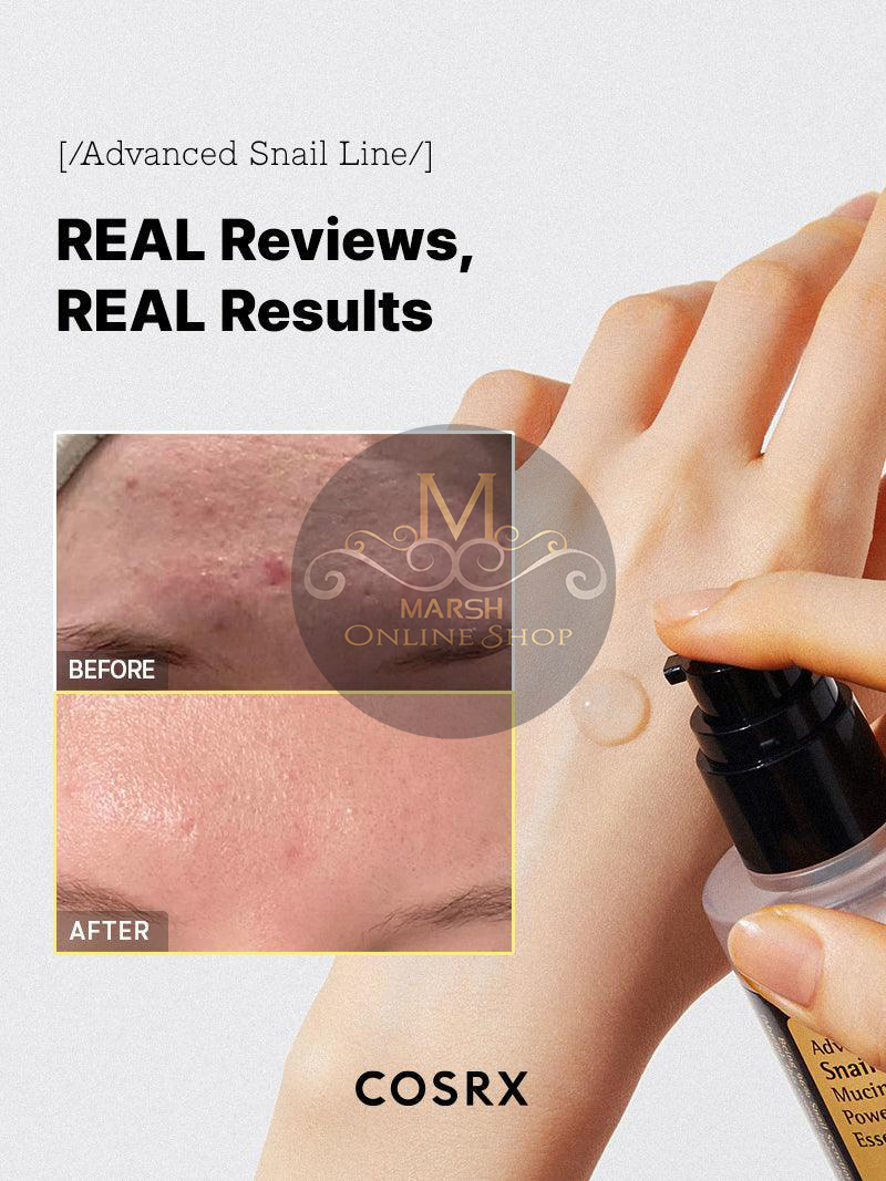 👉🔰Cosrx Advanced Snail 96 Mucin Power Essence (100ml)_img_8