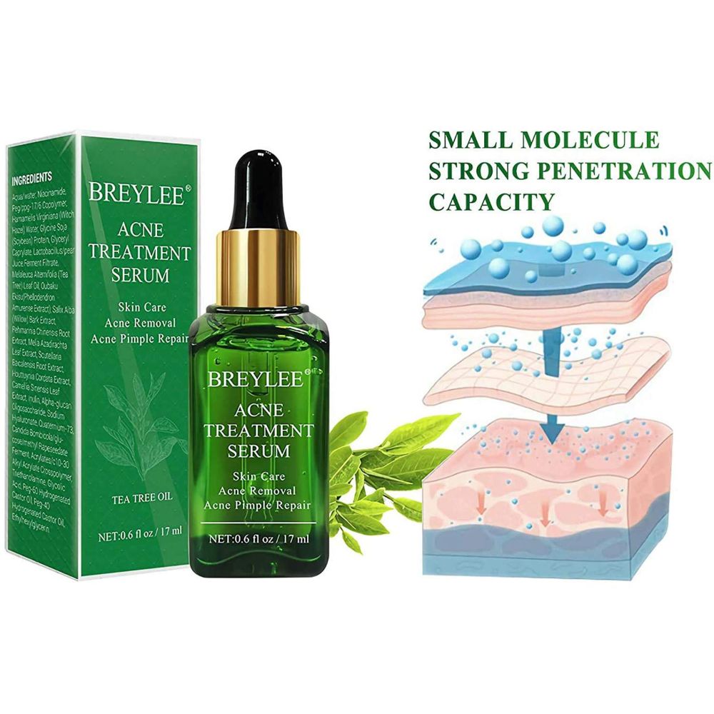 Breylee Acne Treatment Serum