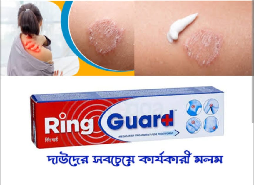 Ring Guard 12gm [ Indian ]_img_1