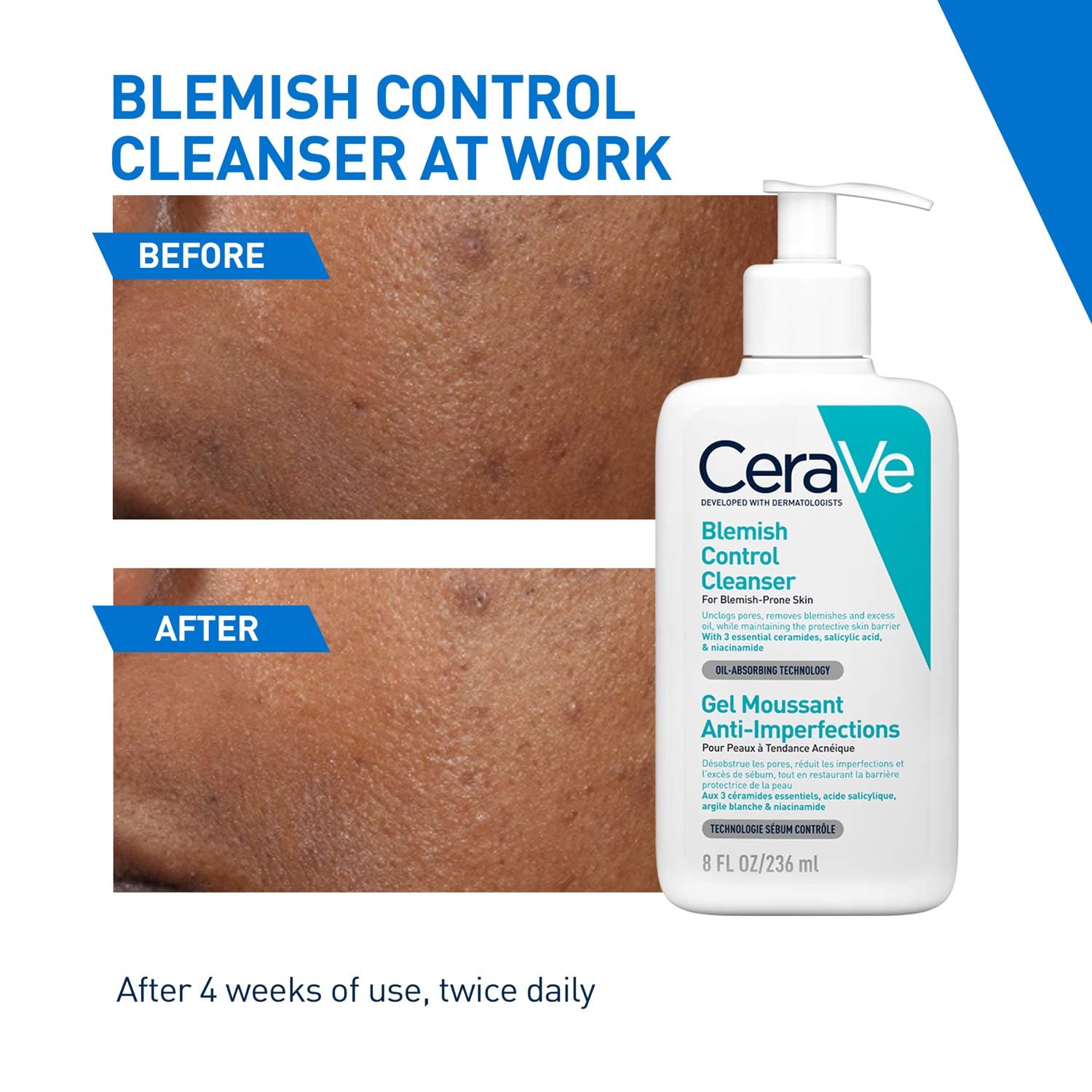 CeraVe Blemish Control Cleanser with 2% Salicylic Acid & Niacinamide for Acne Prone Skin (236ml)_img_3