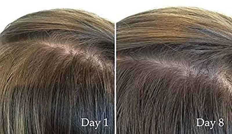 The Ordinary Multi-Peptide Serum for Hair Density 30ML_img_1