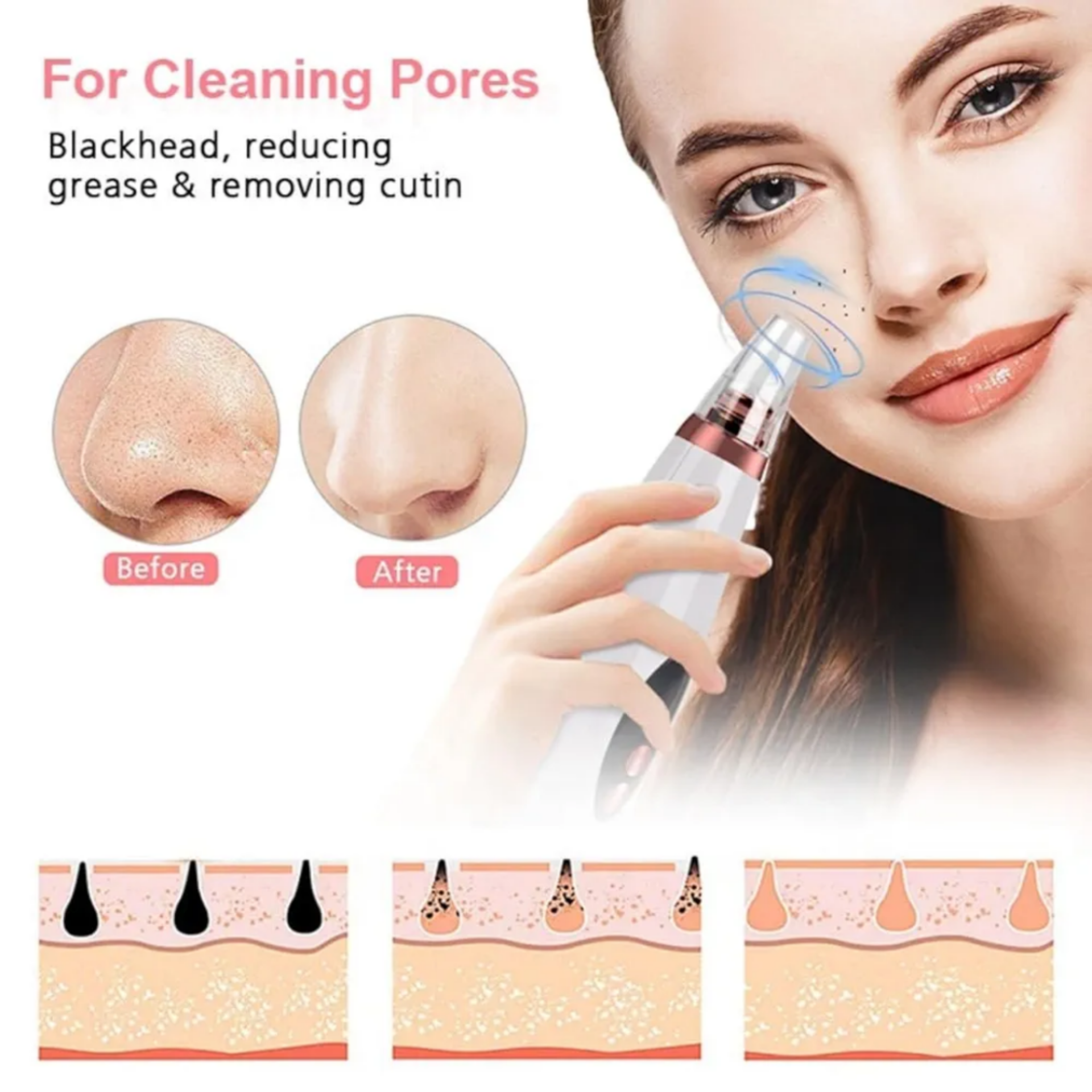Multi-Functional Blackhead Vacuum - Face Cleaner_img_4