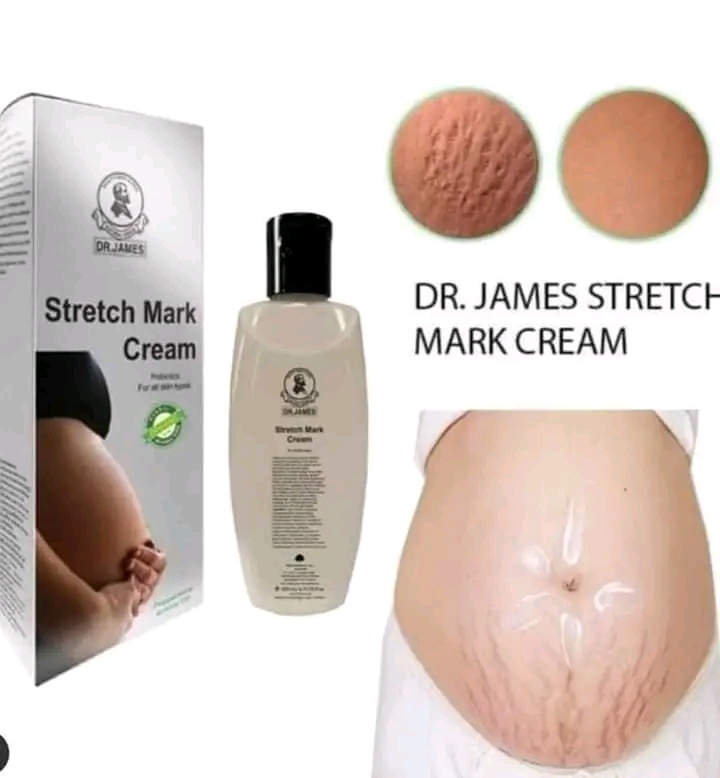 Dr: JAMES 'Stretch Mark Cream_img_2