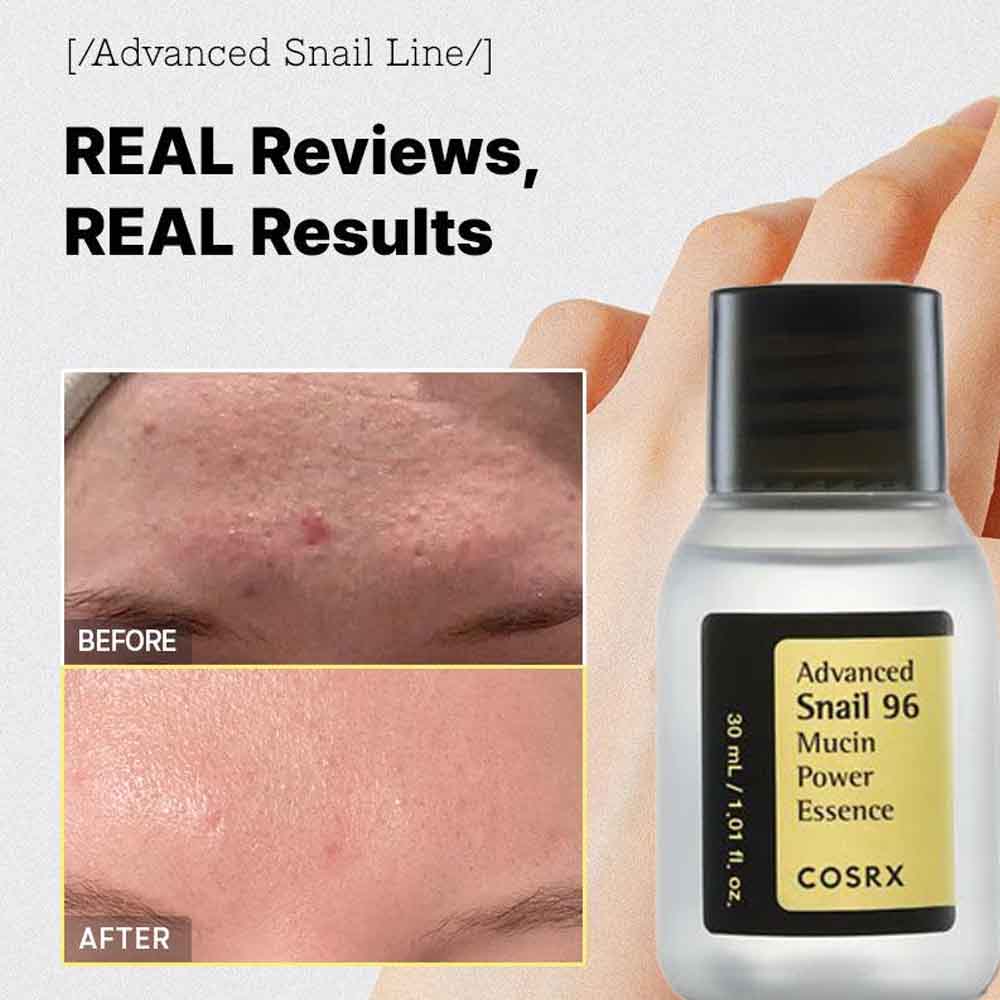 Buy COSRX Snail Mucin 96% Power Repairing Essence 30ml_img_1