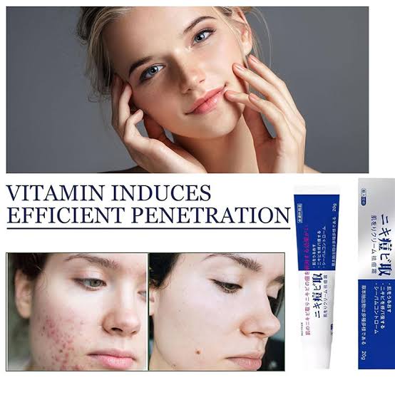 Lion Pair Medicated Acne Care Cream 14g_img_3