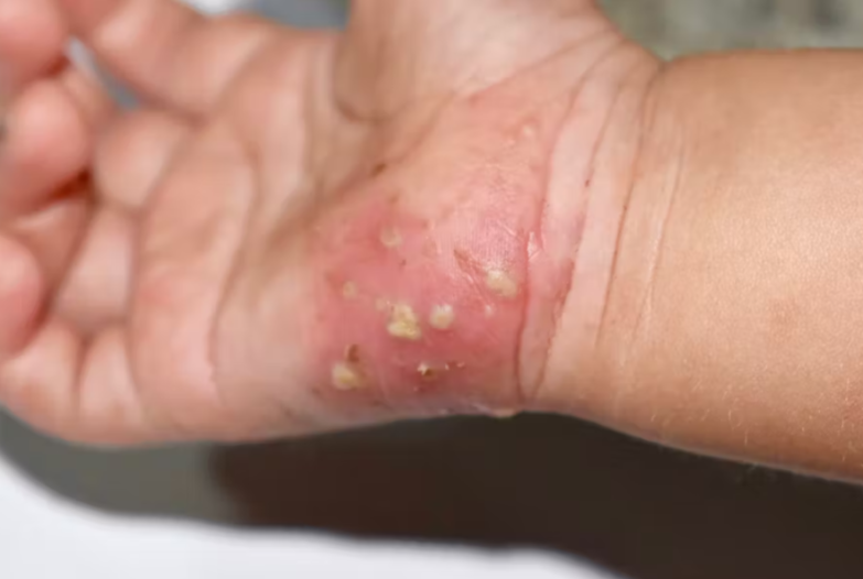 Scrabic Lotion [Indian] শিশুদের জন্য_img_5
