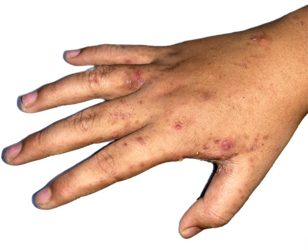 Scrabic Lotion [Indian] শিশুদের জন্য_img_8