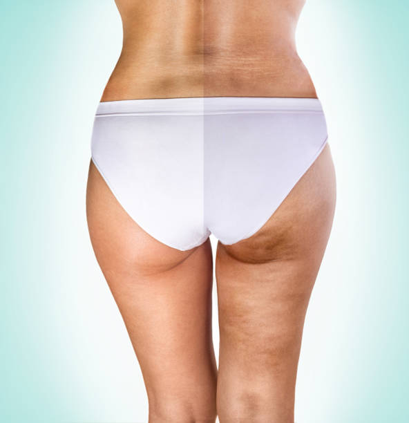 Anti Stretch Mark Cream [ মাতৃত্বের দাগ চিকিৎসায় ]_img_4