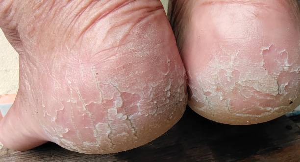 Foot Mark Cream 2 pcs [Indian]_img_5