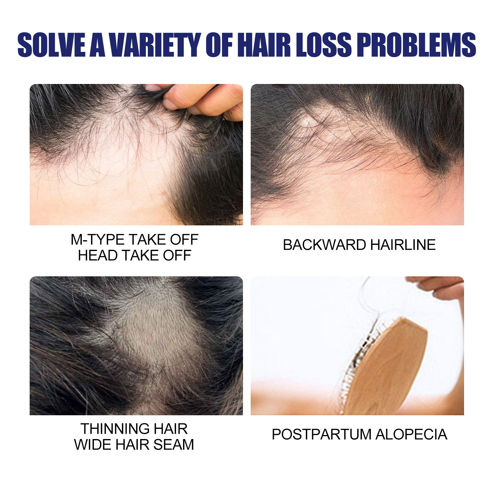 East Moon Hair Growth Foam Hair Deep Repair Roots Hair Follicles Thick Moisturizing Care 60g._img_5