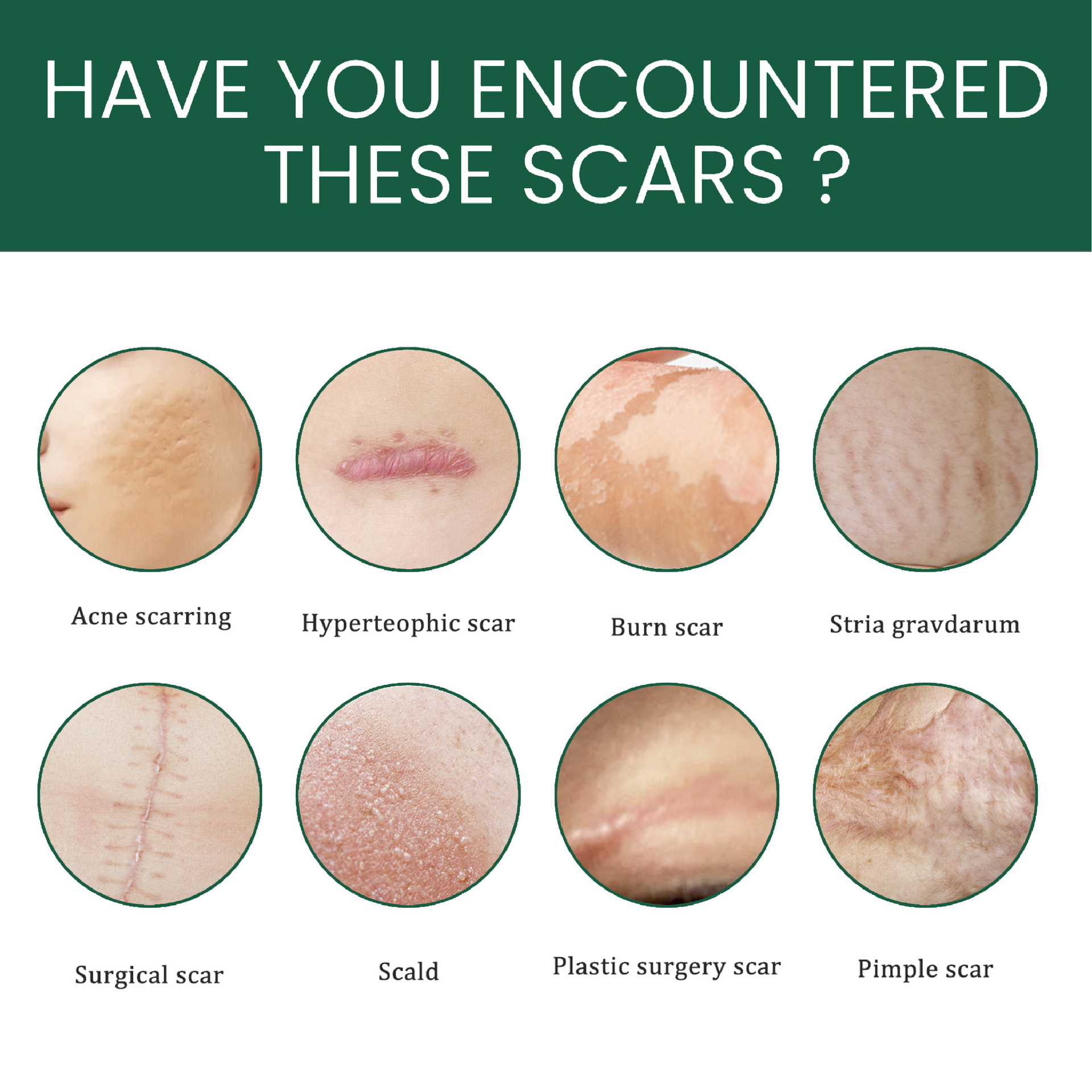 Silicone Gel Scar Patch Roll – Adjustable, Effective Scar Treatment_img_8