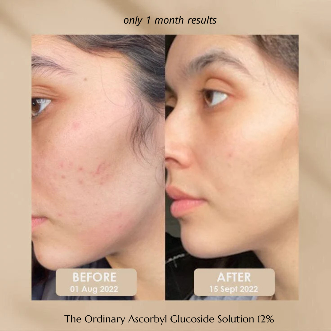 The Ordinary Ascorbyl Glucoside Solution 12%_img_3