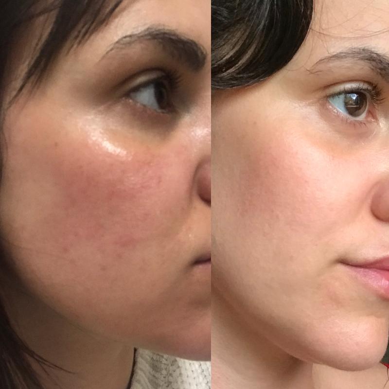 The Ordinary Ascorbyl Glucoside Solution 12%_img_5