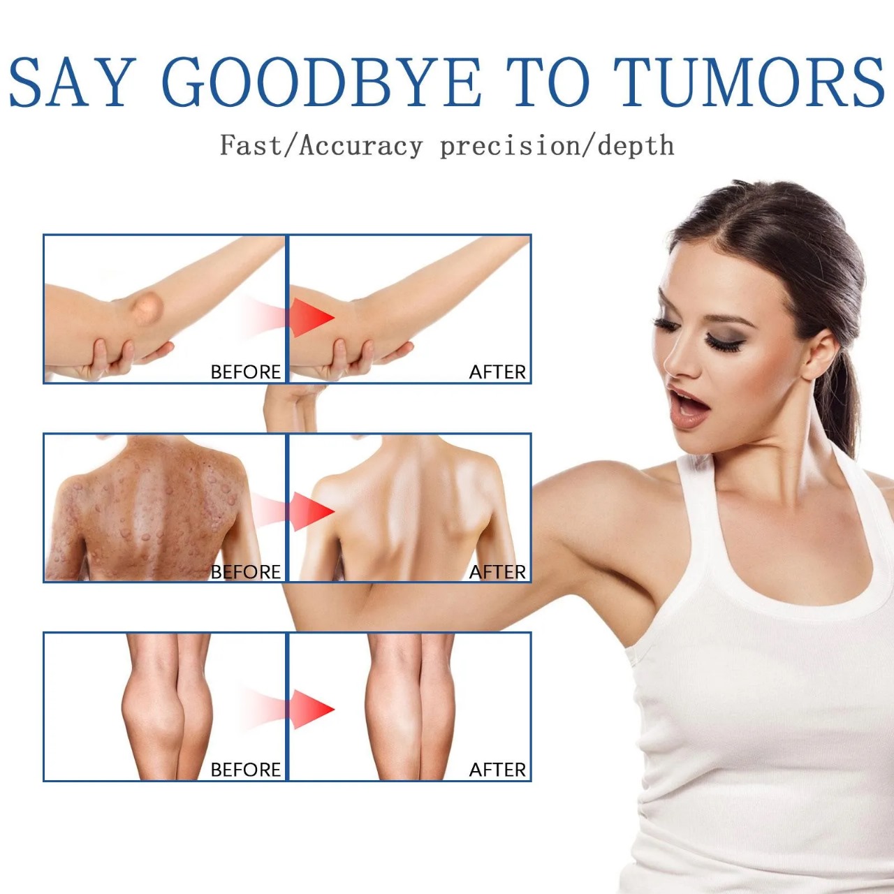 South Moon - Lipoma Remover Spray Relief Lipolysis Fat Lump With Lipoma Spray 50 ml_img_5