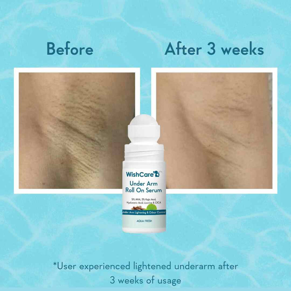 WishCare Underarm Roll On Serum_img_3