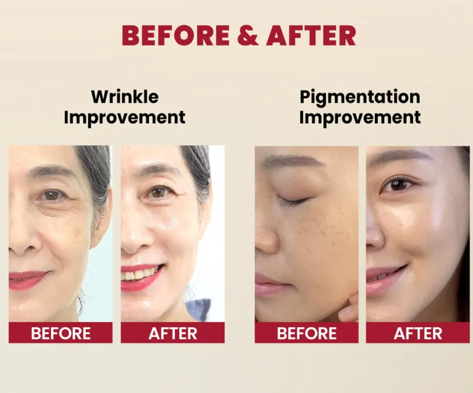 KSECRET - SEOUL 1988 Serum : Retinal Liposome 2% + Black Ginseng_img_3