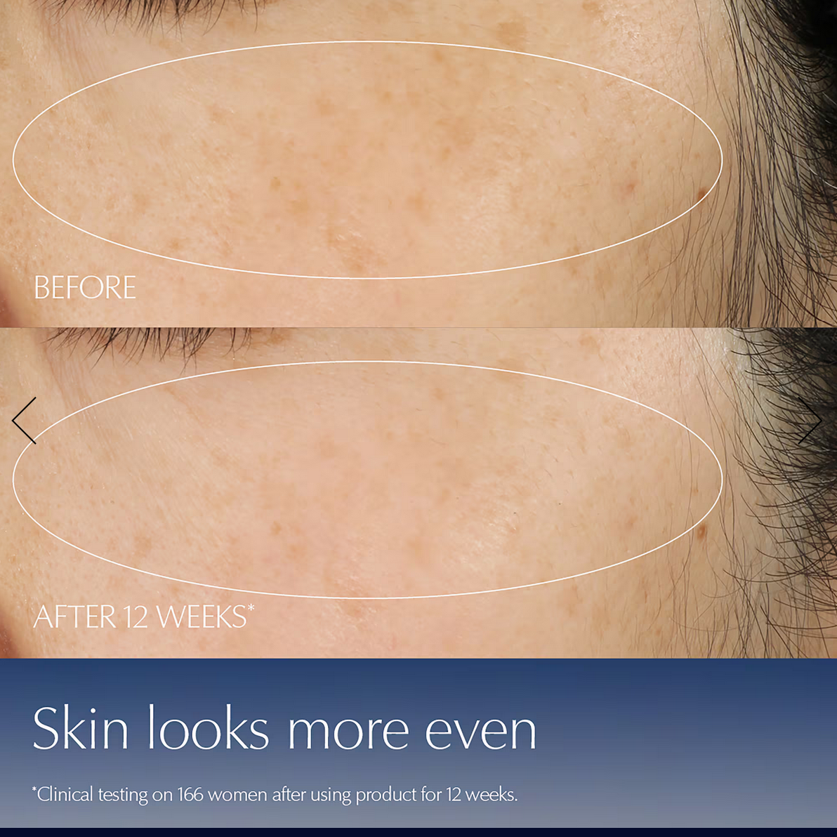 Advanced Night Repair Serum Synchronized Multi-Recovery Complex_img_5